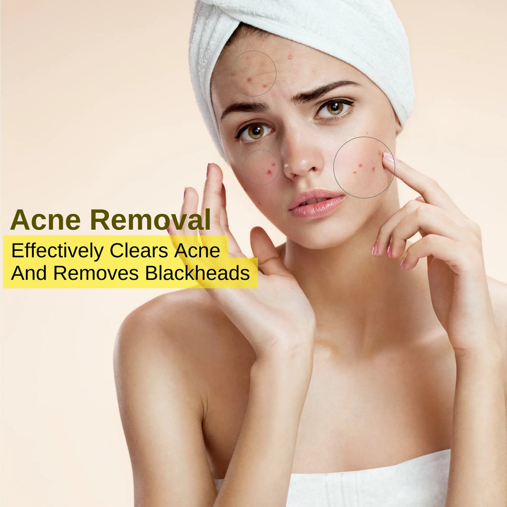 Ammuri Beauty 24K Gold Peel Off Mask for acne removal and blackhead treatment