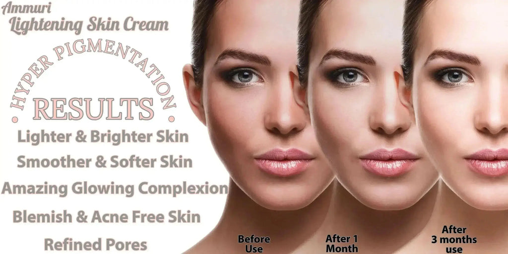 Ammuri Intense Lightening Skin Cream – Brightening for Bikini, Underarms & Sensitive Areas (50g) - Ammuri Beauty