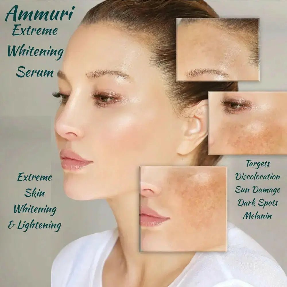Ammuri Skincare Kojic Acid Whitening Serum targeting dark spots and discoloration for skin lightening