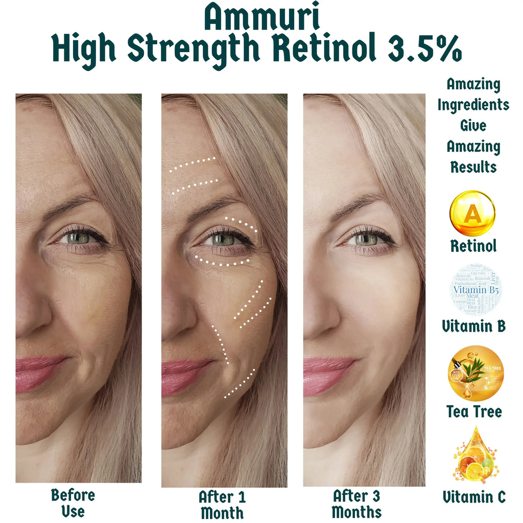 Retinol Face Serum 3.5% High Strength 30ml - with Hyaluronic acid, Vitamin C, E, B3, Aloe Vera - Ammuri Beauty