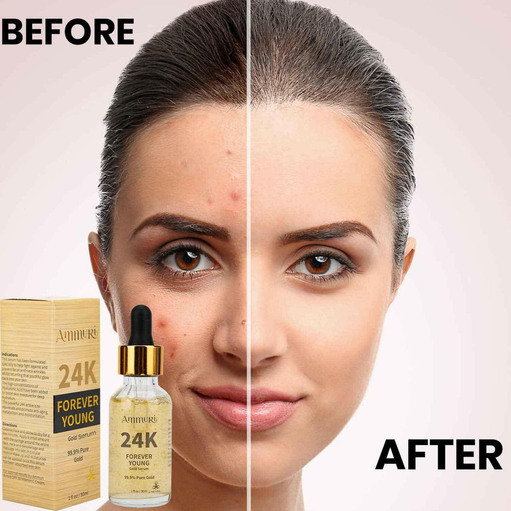 Ammuri Beauty 24K gold face serum displayed next to before and after images demonstrating skin improvement