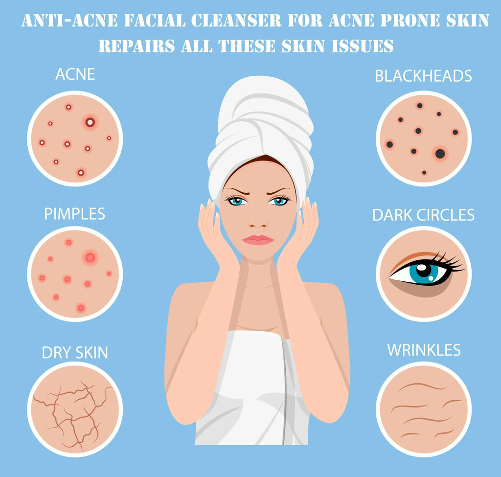 Ammuri Skincare 3-in-1 Deep Cleansing Milk effective for acne, blackheads, and dry skin