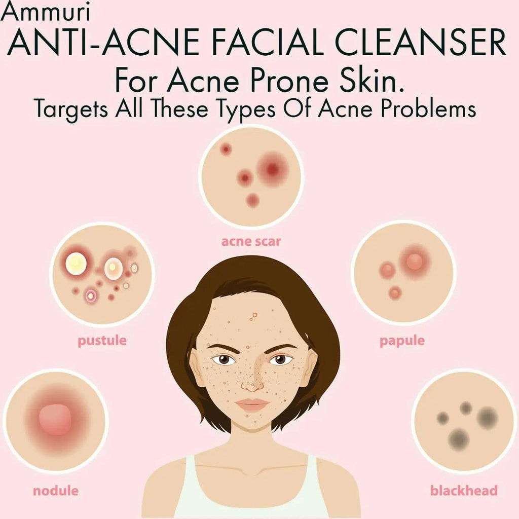 Ammuri Skincare 3-in-1 Deep Cleansing Milk for acne-prone skin with anti-acne properties