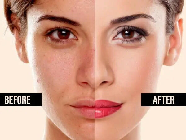 A before and after comparison showcasing the results of Ammuri Skincare Glutathione skin brightening cream on the face