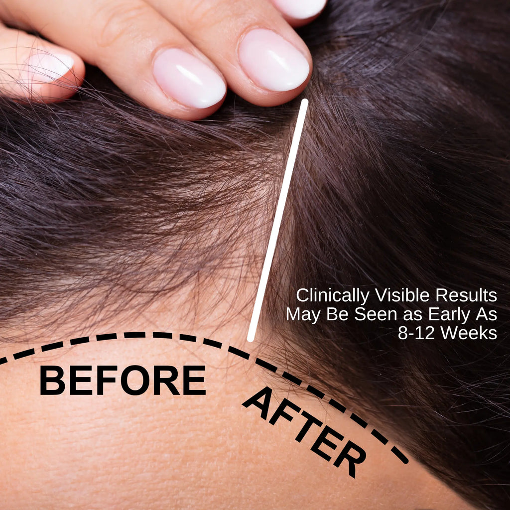 Ammuri Skincare Hair Growth Serum showing before and after results as a hair loss solution