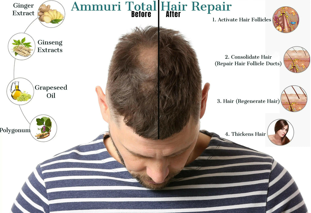 Ammuri Skincare Hair Growth Serum visual showing before and after results as a hair loss solution