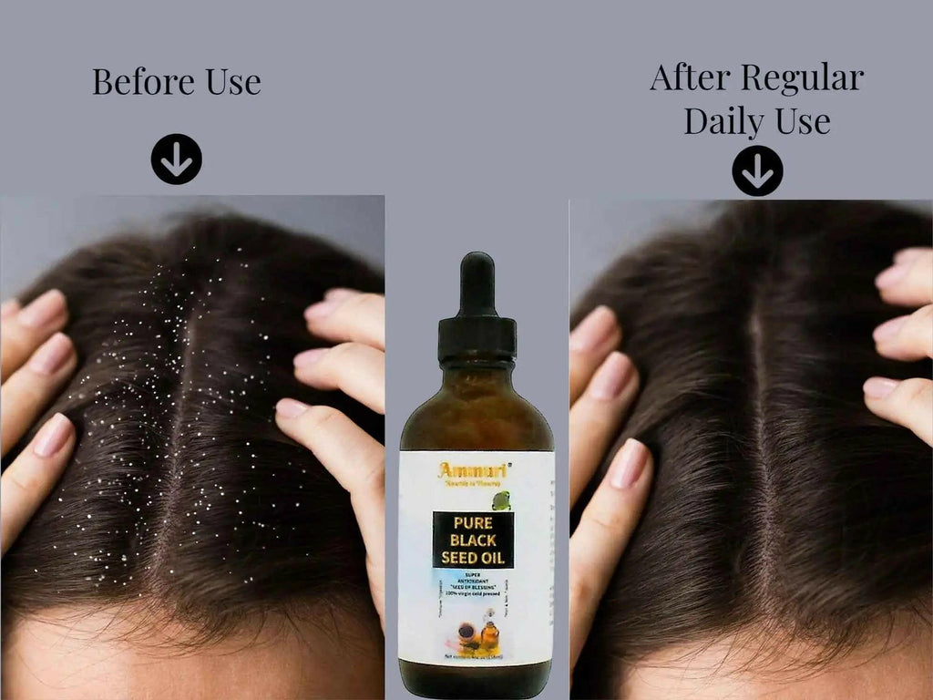 Comparison image showing before and after results of using Ammuri organic black seed oil for healthy hair