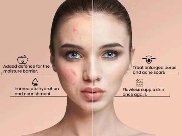 Q10 face cream for hydration and firming, visibly improving skin texture and reducing pores and scars