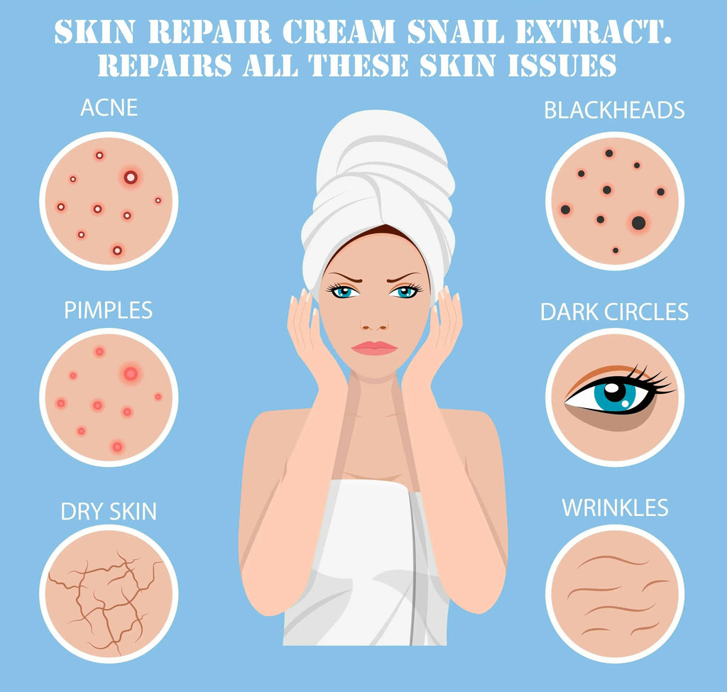 Ammuri Bioactive Snail Repair Cream for acne, pimples, blackheads, dark circles, dry skin, and wrinkles with snail extract skin cream