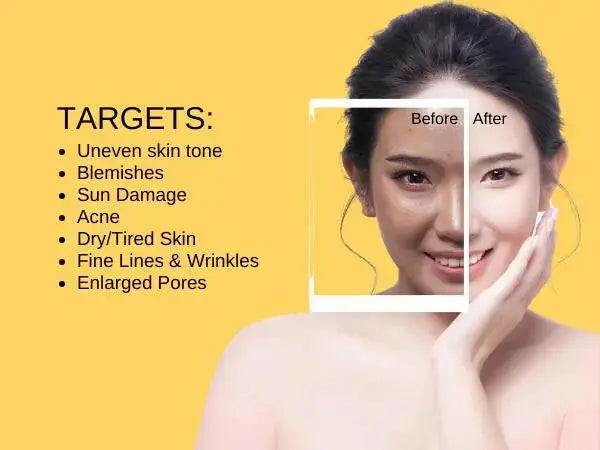Ammuri Vitamin C Moisturiser SPF 50 anti-aging moisturizer targeting uneven skin tone and wrinkles