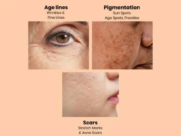 Ammuri Skincare Apple Stem Cell Age Reverse Cream for reducing age lines, pigmentation, and scars