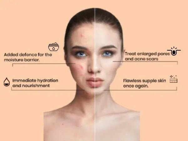 Ammuri Skincare retinol apple stem cell cream benefits including hydration and treatment for enlarged pores