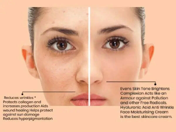 Ammuri Skincare Apple Stem Cell Age Reverse Cream with retinol apple stem cell cream benefits for skin rejuvenation
